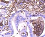S100A4 Antibody in Immunohistochemistry (Paraffin) (IHC (P))