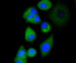 AP2M1 Antibody in Immunocytochemistry (ICC/IF)