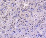ATF4 Recombinant Rabbit Monoclonal Antibody (SD20-92)