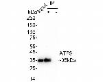 ATF5 Antibody in Immunoprecipitation (IP)