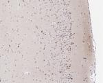 Phospho-MEK1 (Thr292) Antibody in Immunohistochemistry (Paraffin) (IHC (P))