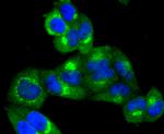 TRK fused gene Antibody in Immunocytochemistry (ICC/IF)