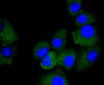 TRK fused gene Antibody in Immunocytochemistry (ICC/IF)