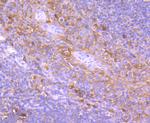 TRK fused gene Antibody in Immunohistochemistry (Paraffin) (IHC (P))
