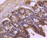 TRK fused gene Antibody in Immunohistochemistry (Paraffin) (IHC (P))