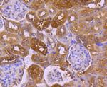 TRK fused gene Antibody in Immunohistochemistry (Paraffin) (IHC (P))