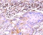 TRK fused gene Antibody in Immunohistochemistry (Paraffin) (IHC (P))