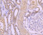 TRK fused gene Antibody in Immunohistochemistry (Paraffin) (IHC (P))