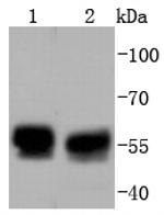 TRK fused gene Antibody in Western Blot (WB)