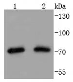 TRAP1 Recombinant Rabbit Monoclonal Antibody (SD08-71)