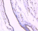 TRIM28 Recombinant Rabbit Monoclonal Antibody (SD081-05)