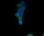 FGFR1 Recombinant Rabbit Monoclonal Antibody (SD08-25)