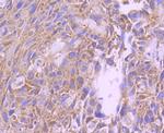 FOXO4 Recombinant Rabbit Monoclonal Antibody (SD0817)