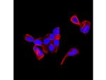 KRT9 Recombinant Rabbit Monoclonal Antibody (SD201-09)
