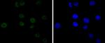 CDK9 Antibody in Immunocytochemistry (ICC/IF)
