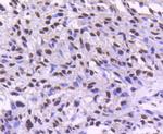 CDK9 Antibody in Immunohistochemistry (Paraffin) (IHC (P))