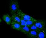 RON Recombinant Rabbit Monoclonal Antibody (SD2006)