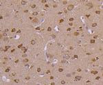 HSPA4 Antibody in Immunohistochemistry (Paraffin) (IHC (P))