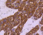 HSPA4 Antibody in Immunohistochemistry (Paraffin) (IHC (P))