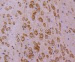 HSPA4 Antibody in Immunohistochemistry (Paraffin) (IHC (P))