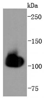 HSPA4 Antibody in Western Blot (WB)