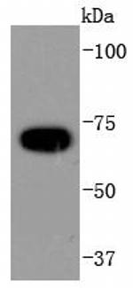 APC6 Recombinant Rabbit Monoclonal Antibody (SD085-8)