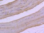 Phospho-c-Raf (Ser259) Antibody in Immunohistochemistry (Paraffin) (IHC (P))
