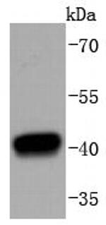 HDAC8 Recombinant Rabbit Monoclonal Antibody (SD082-07)