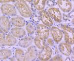 HSPA14 Antibody in Immunohistochemistry (Paraffin) (IHC (P))