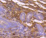 MEKK3 Antibody in Immunohistochemistry (Paraffin) (IHC (P))
