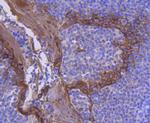 Cytokeratin 2e Recombinant Rabbit Monoclonal Antibody (JJ201-8)