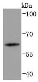 Cytokeratin 2e Antibody in Western Blot (WB)