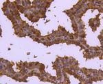 Cdc37 Recombinant Rabbit Monoclonal Antibody (JJ087-06)