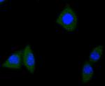 TrkA/TrkB/TrkC Recombinant Rabbit Monoclonal Antibody (JJ084-04)