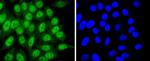 CDK7 Recombinant Rabbit Monoclonal Antibody (JJ203-01)