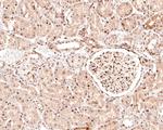 Phospho-c-Raf (Ser621) Recombinant Rabbit Monoclonal Antibody (JJ085-05)