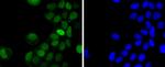 Phospho-c-Jun (Thr91) Recombinant Rabbit Monoclonal Antibody (JJ080-9)