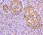 GLUT2 Recombinant Rabbit Monoclonal Antibody (JJ20-21)