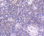 Phospho-JunD (Ser255) Antibody in Immunohistochemistry (Paraffin) (IHC (P))