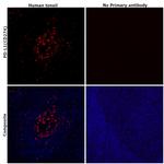 PD-L1 (CD274) Antibody in Immunohistochemistry (Paraffin) (IHC (P))