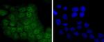 STAT5 alpha/beta Antibody in Immunocytochemistry (ICC/IF)