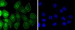 Caspase 14 Recombinant Rabbit Monoclonal Antibody (JJ089-01)