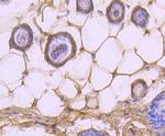 Caspase 14 Antibody in Immunohistochemistry (Paraffin) (IHC (P))