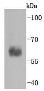 Caspase 10 Antibody in Western Blot (WB)