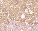 SOD2 (MnSOD) Antibody in Immunohistochemistry (Paraffin) (IHC (P))