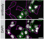 ARID1A Recombinant Rabbit Monoclonal Antibody (JJ09-01)