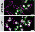 ARID1A Antibody