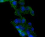 HDAC6 Antibody in Immunocytochemistry (ICC/IF)
