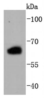 Estrogen Receptor beta Recombinant Rabbit Monoclonal Antibody (JJ09-02)