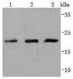 Cdc42 Recombinant Rabbit Monoclonal Antibody (JJ086-04)
